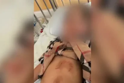 Λύκος επιτέθηκε και τραυμάτισε ένα 5χρονο κοριτσάκι